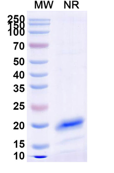 Human IGHM Nanobody Antibody