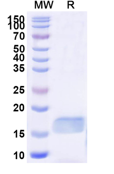 Human RAGE-1/MOK Nanobody Antibody