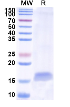 HSV Glycoprotein B/gB Nanobody Antibody