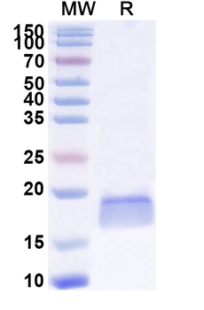 Clostridium botulinum botA/BoNT Nanobody Antibody