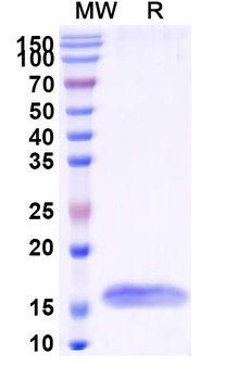 HSV Glycoprotein B/gB Nanobody Antibody