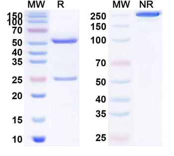 Human APP/Amyloid beta Antibody
