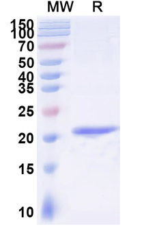 Human CD32b/FCGR2B Nanobody Antibody