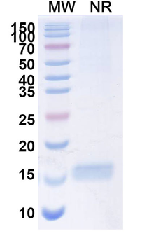 Human LGR4 Nanobody Antibody