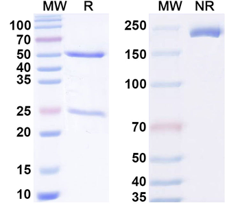 Human ARG1 Monoclonal Antibody