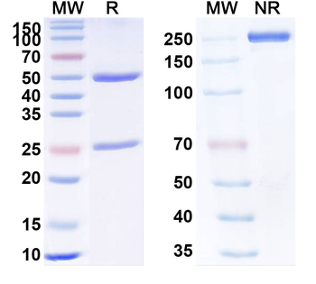 Human PHOX2B Monoclonal Antibody