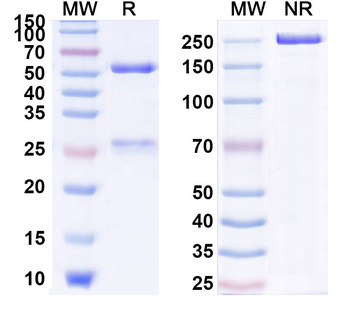 Human CALD1 Monoclonal Antibody
