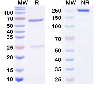 Human PIP Monoclonal Antibody