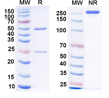 Human CD21/CR2 Monoclonal Antibody