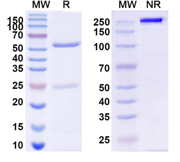 Human CXCL16/SR-PSOX Monoclonal Antibody