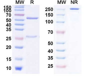 Human CD2AP Monoclonal Antibody