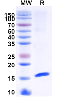 Castor bean Ricin Nanobody Antibody
