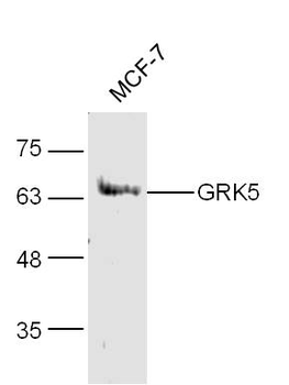 GRK5 Rabbit Polyclonal Antibody