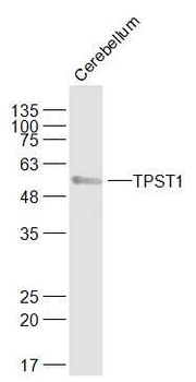 TPST1 Rabbit Polyclonal Antibody