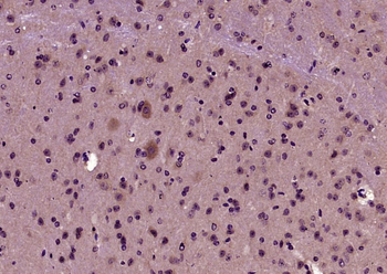 CDC2L6 Rabbit Polyclonal Antibody