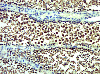 DOCK1 Rabbit Polyclonal Antibody
