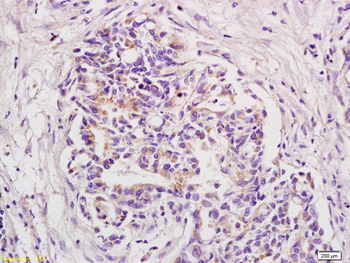 BOD1 Rabbit Polyclonal Antibody