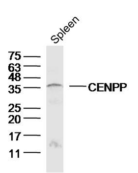 CENPP Rabbit Polyclonal Antibody