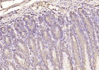 SMC6 Rabbit Polyclonal Antibody