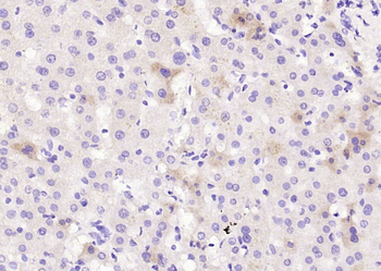 Factor VII light chain Rabbit Polyclonal Antibody