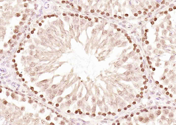 BABAM2 Rabbit Polyclonal Antibody