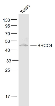 BABAM2 Rabbit Polyclonal Antibody