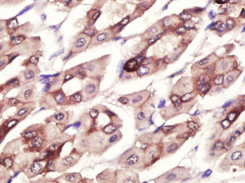 CDCP1 Rabbit Polyclonal Antibody