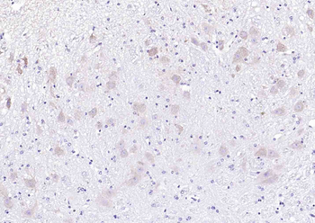 NARC1/PCSK9 Rabbit Polyclonal Antibody