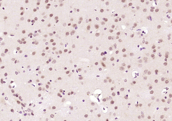 RBBP4 Rabbit Polyclonal Antibody