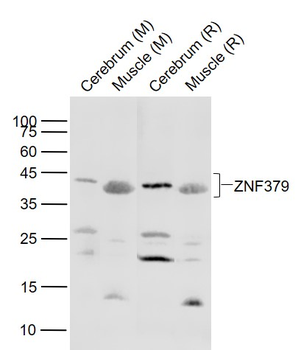 ZNF379 Rabbit Polyclonal Antibody