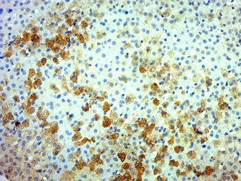 Ret Rabbit Polyclonal Antibody