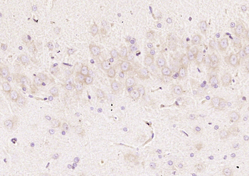 CKAP4 Rabbit Polyclonal Antibody