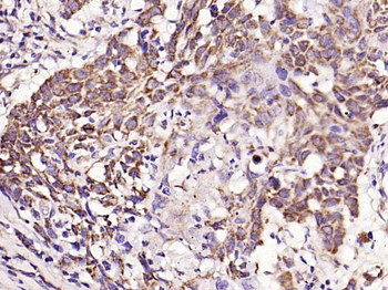 TIMP-1 Rabbit Polyclonal Antibody