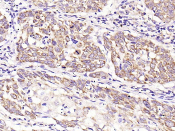 TIMP-1 Rabbit Polyclonal Antibody