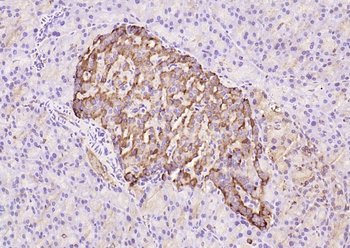 TIMP-1 Rabbit Polyclonal Antibody