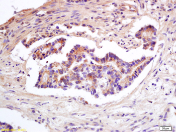 TIMP-1 Rabbit Polyclonal Antibody