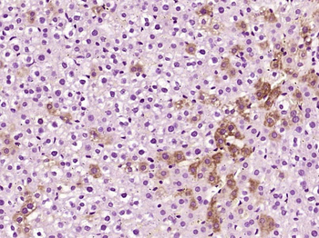 AAT Rabbit Polyclonal Antibody