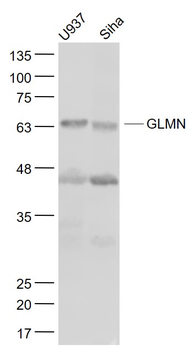 GLMN Rabbit Polyclonal Antibody
