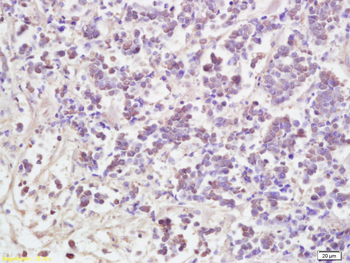 AATF Rabbit Polyclonal Antibody