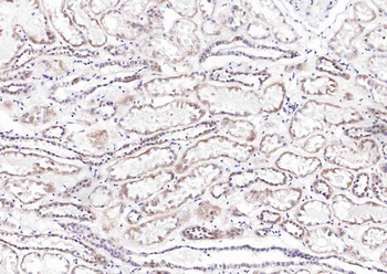 TIRAP Rabbit Polyclonal Antibody