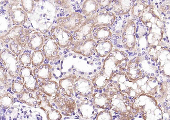 TIRAP Rabbit Polyclonal Antibody