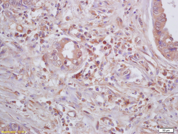 Beta galactosidase Rabbit Polyclonal Antibody