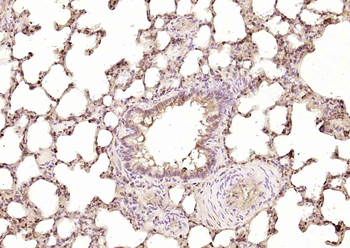 DAP1 Rabbit Polyclonal Antibody