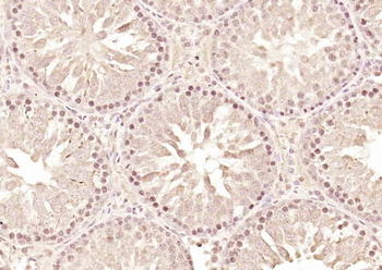 DAP1 Rabbit Polyclonal Antibody