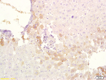 ABCB6 Rabbit Polyclonal Antibody