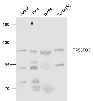 TP53TG3 Rabbit Polyclonal Antibody