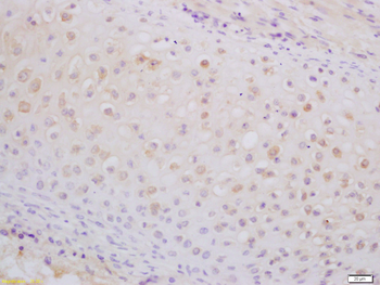 PCNT Rabbit Polyclonal Antibody