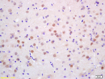CDC10 Rabbit Polyclonal Antibody