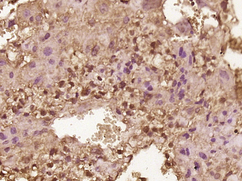 MBNL3 Rabbit Polyclonal Antibody