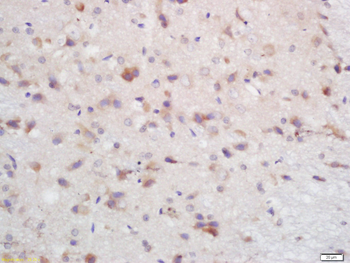 MARK2 Rabbit Polyclonal Antibody